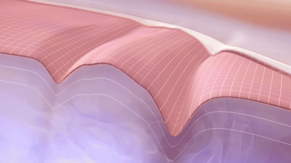cce255bcec4d9670783856e6586ab9c2_1742204998_191.gif